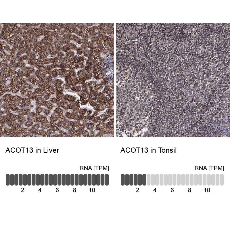 Atlas Antibodies Anti-ACOT13 Antibody