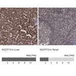 Atlas Antibodies Anti-ACOT13 Antibody