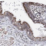 Atlas Antibodies Anti-ACOT9 Antibody