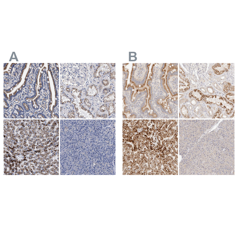 Atlas Antibodies Anti-ACOX1 Antibody
