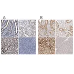 Atlas Antibodies Anti-ACOX1 Antibody