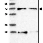 Atlas Antibodies Anti-ACOX3 Antibody