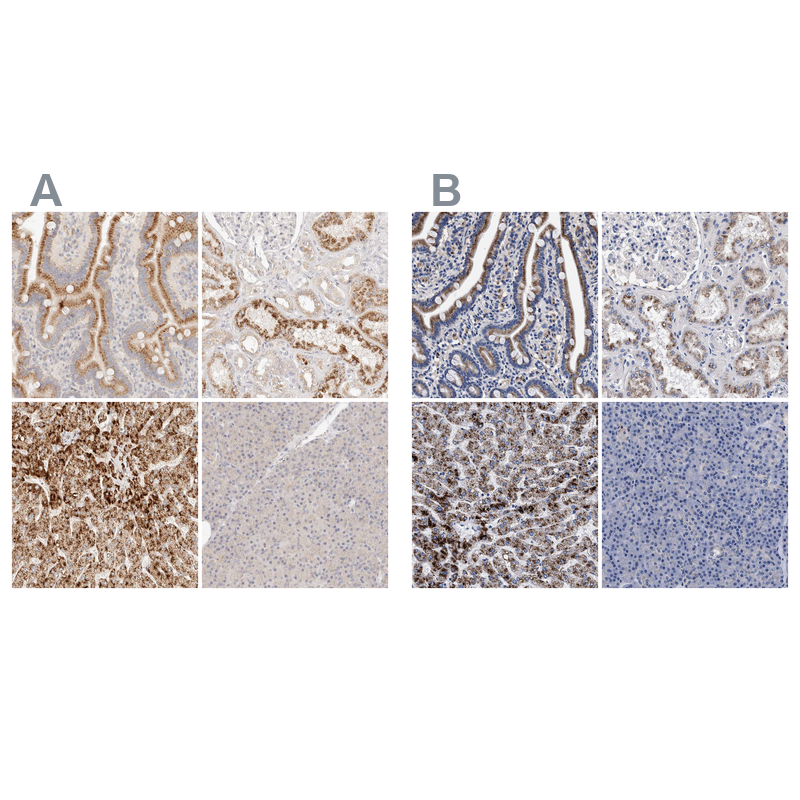 Atlas Antibodies Anti-ACOX1 Antibody