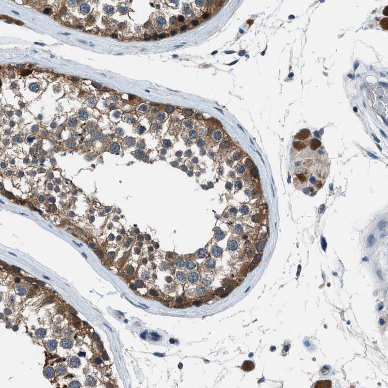 Atlas Antibodies Anti-ACP1 Antibody