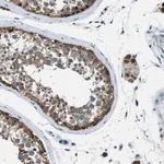 Atlas Antibodies Anti-ACP1 Antibody
