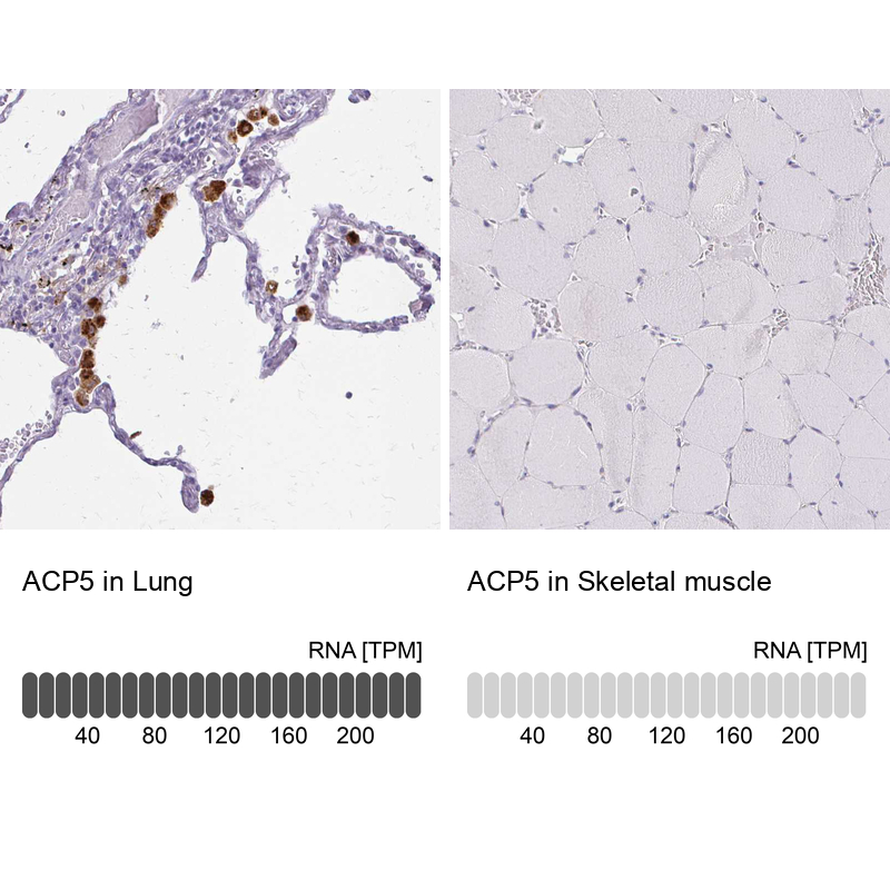 Atlas Antibodies Anti-ACP5 Antibody