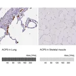 Atlas Antibodies Anti-ACP5 Antibody