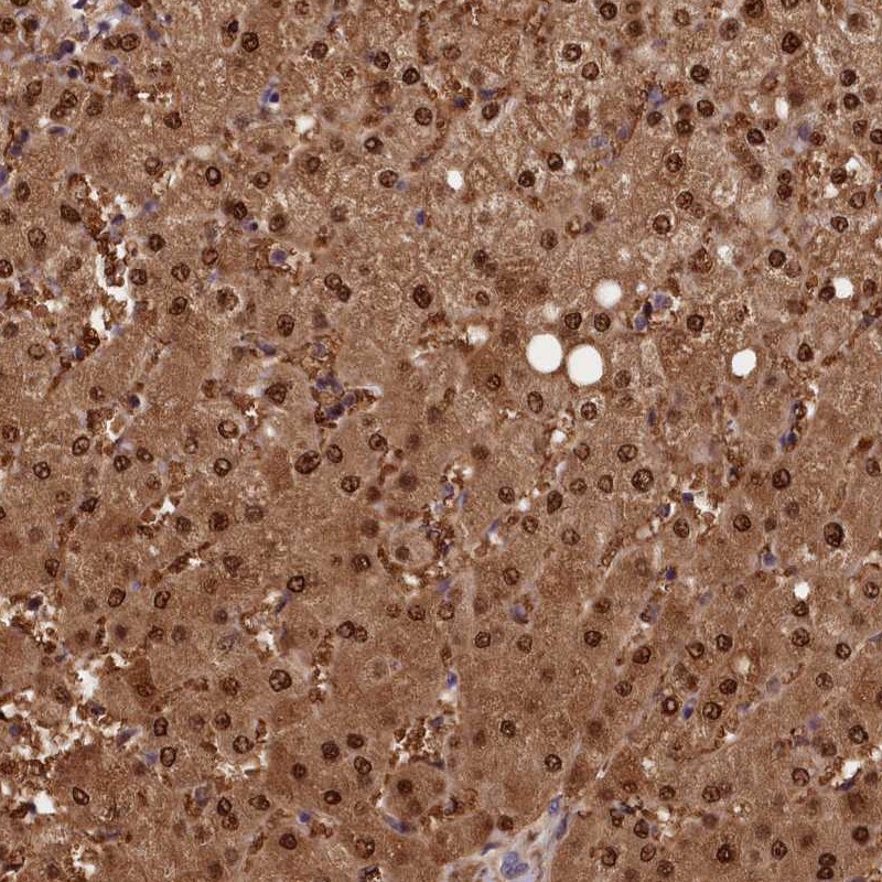 Atlas Antibodies Anti-ACP7 Antibody