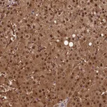 Atlas Antibodies Anti-ACP7 Antibody
