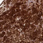 Atlas Antibodies Anti-ACSBG1 Antibody