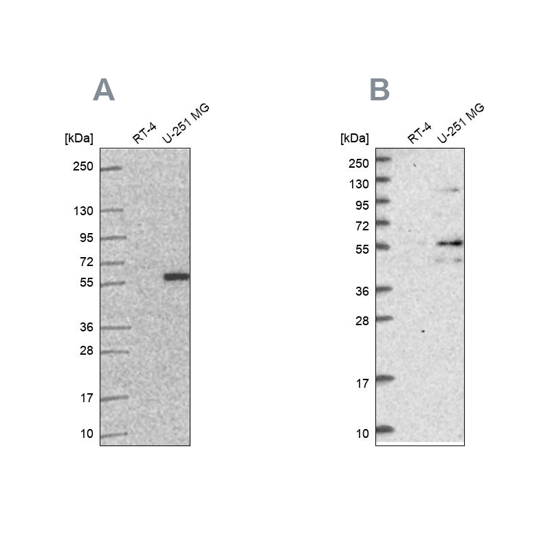 Atlas Antibodies Anti-ACSBG1 Antibody