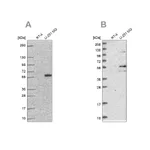 Atlas Antibodies Anti-ACSBG1 Antibody