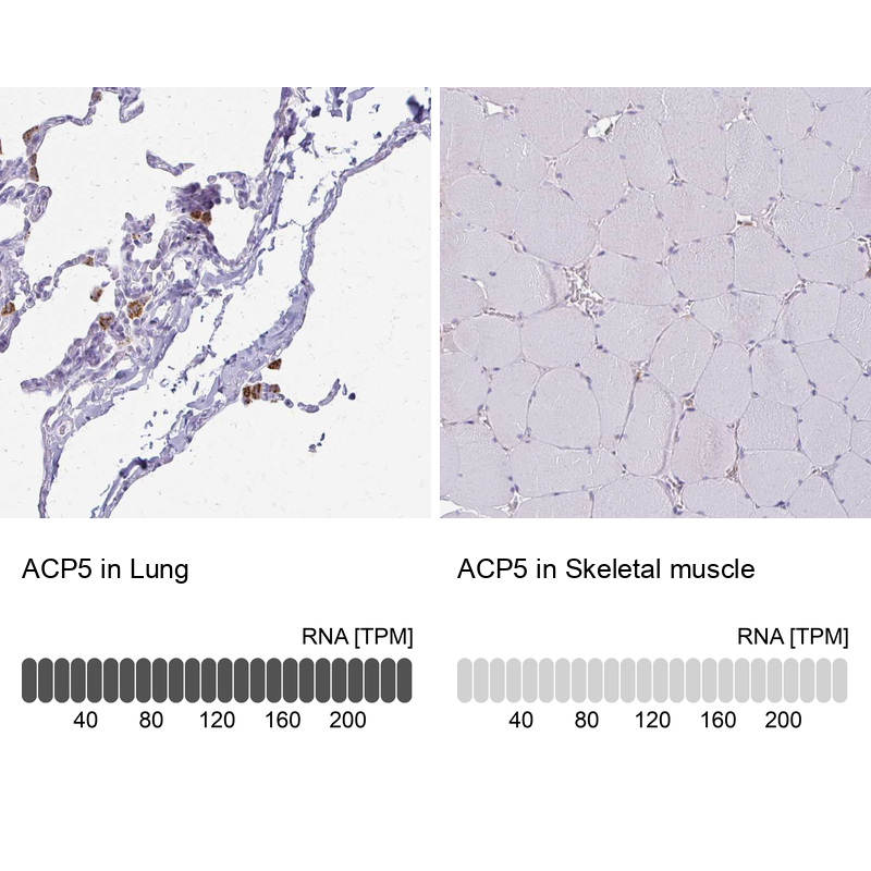 Atlas Antibodies Anti-ACP5 Antibody