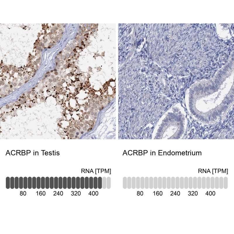 Atlas Antibodies Anti-ACRBP Antibody