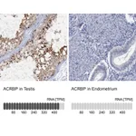 Atlas Antibodies Anti-ACRBP Antibody