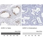 Atlas Antibodies Anti-ACRV1 Antibody