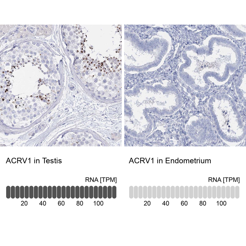 Atlas Antibodies Anti-ACRV1 Antibody