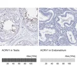 Atlas Antibodies Anti-ACRV1 Antibody