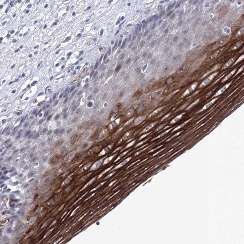 Atlas Antibodies Anti-ACOX3 Antibody