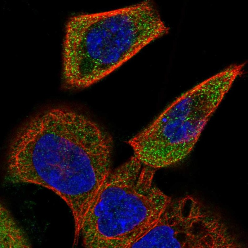 Atlas Antibodies Anti-ACOXL Antibody