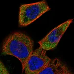 Atlas Antibodies Anti-ACOXL Antibody