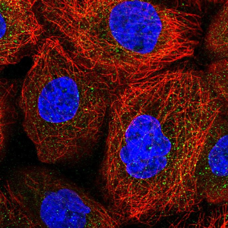 Atlas Antibodies Anti-ACOXL Antibody