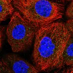 Atlas Antibodies Anti-ACOXL Antibody