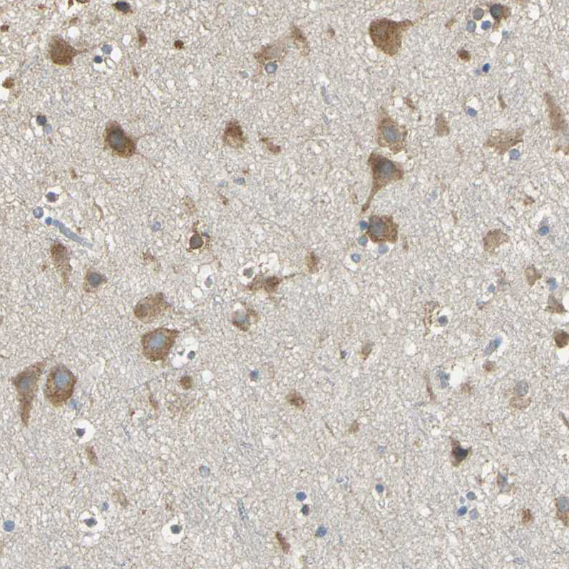 Atlas Antibodies Anti-ACSL4 Antibody