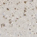 Atlas Antibodies Anti-ACSL4 Antibody