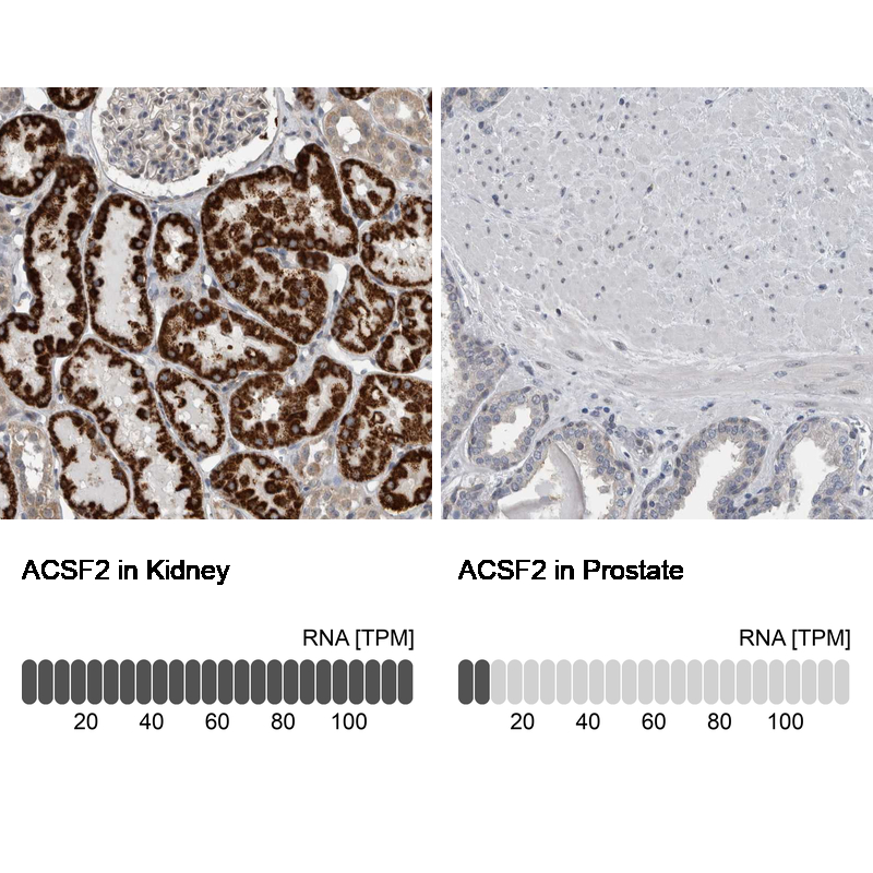Atlas Antibodies Anti-ACSF2 Antibody