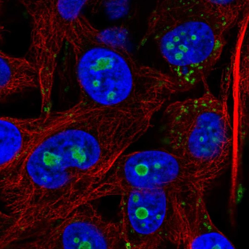 Atlas Antibodies Anti-ACSL3 Antibody