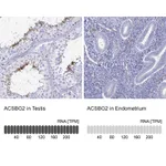 Atlas Antibodies Anti-ACSBG2 Antibody