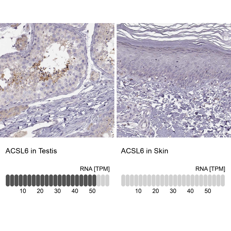 Atlas Antibodies Anti-ACSL6 Antibody