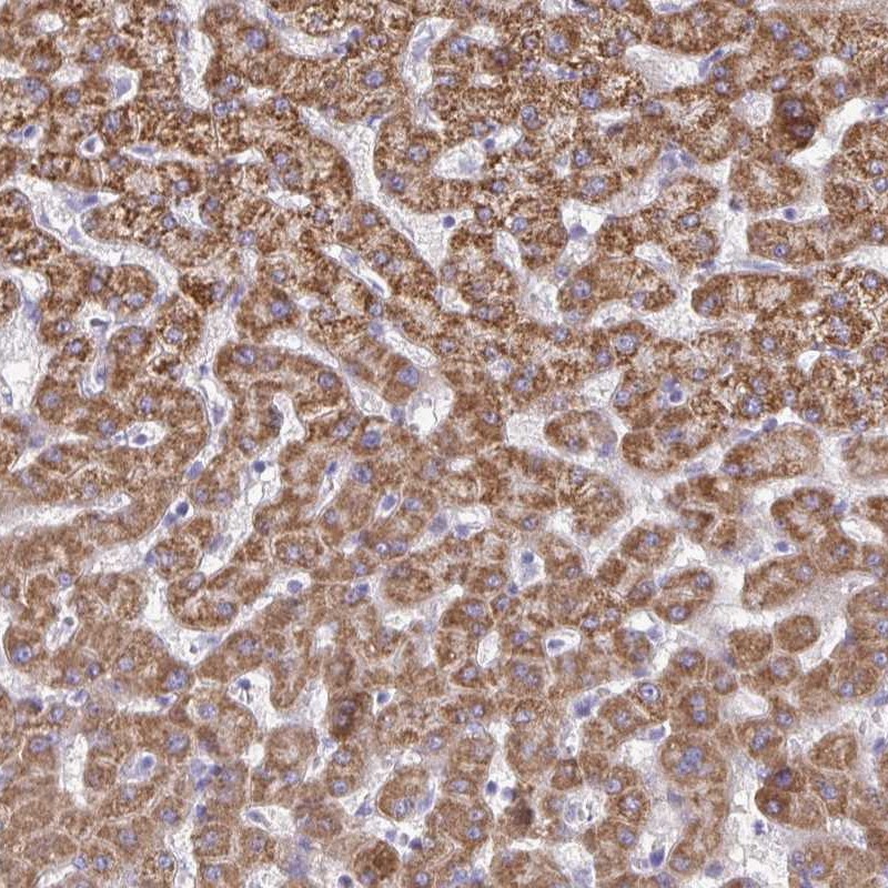 Atlas Antibodies Anti-ACSM2A Antibody