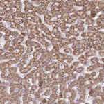 Atlas Antibodies Anti-ACSM2A Antibody