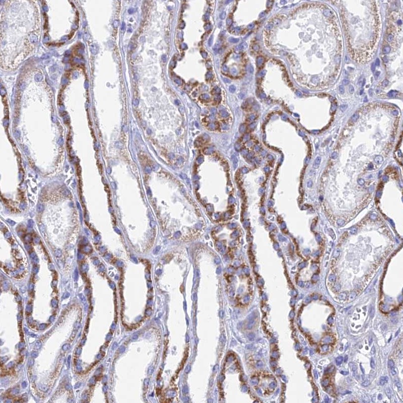 Atlas Antibodies Anti-ACSM1 Antibody