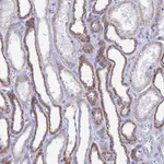 Atlas Antibodies Anti-ACSM1 Antibody