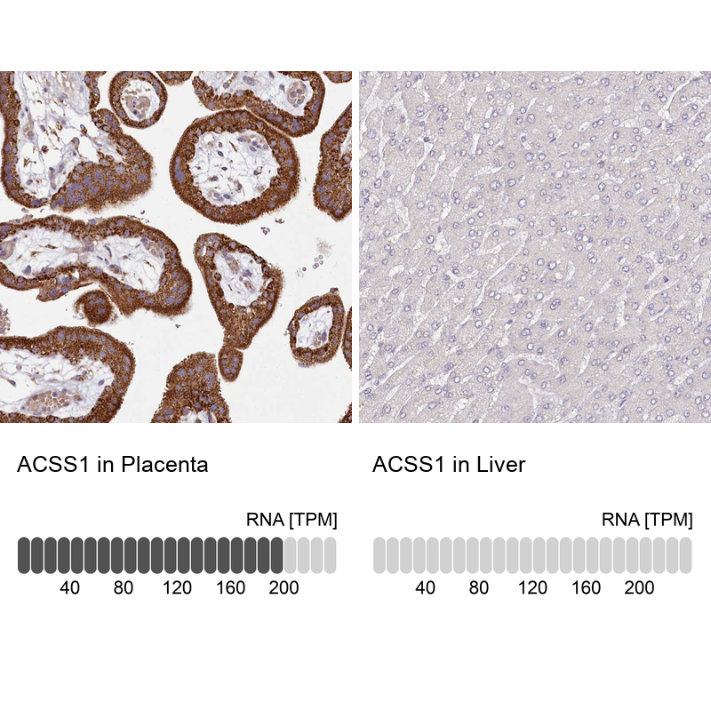 Atlas Antibodies Anti-ACSS1 Antibody
