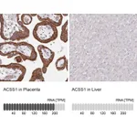 Atlas Antibodies Anti-ACSS1 Antibody