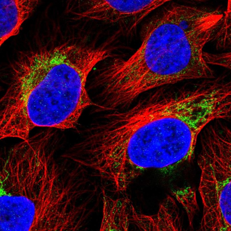 Atlas Antibodies Anti-ACSS3 Antibody