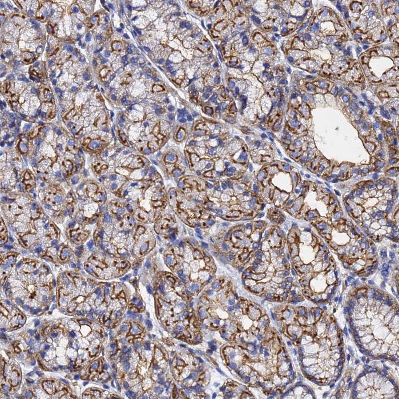 Atlas Antibodies Anti-ACTB Antibody