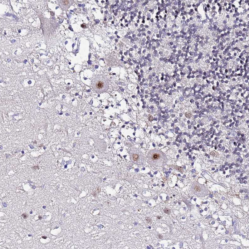 Atlas Antibodies Anti-ACTL6B Antibody