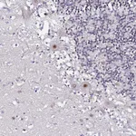 Atlas Antibodies Anti-ACTL6B Antibody