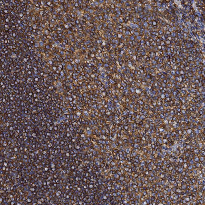 Atlas Antibodies Anti-ACTB Antibody