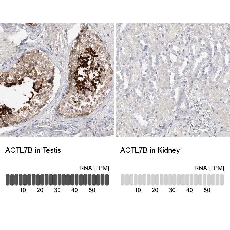 Atlas Antibodies Anti-ACTL7B Antibody