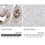 Atlas Antibodies Anti-ACTL7B Antibody