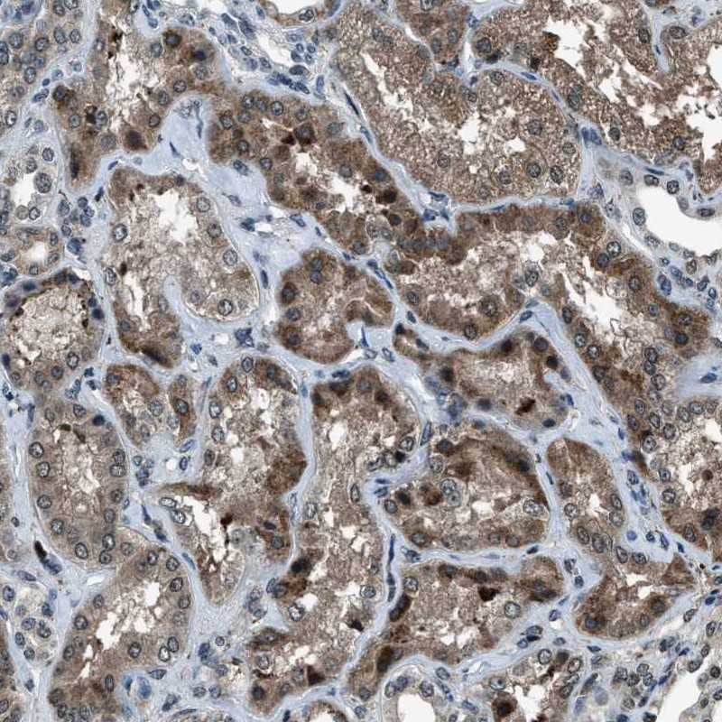 Atlas Antibodies Anti-ACTL9 Antibody