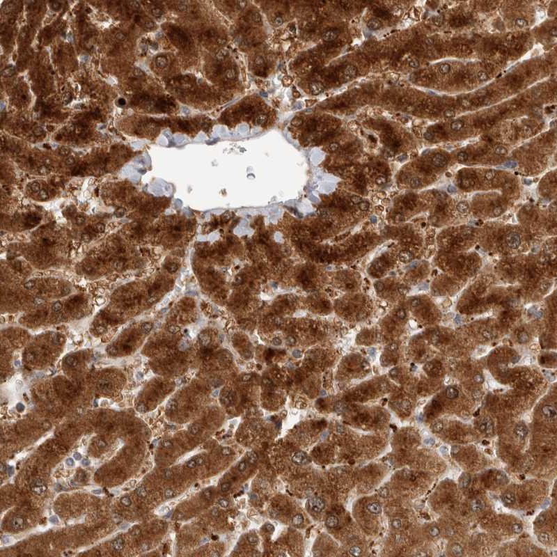 Atlas Antibodies Anti-ACTL9 Antibody