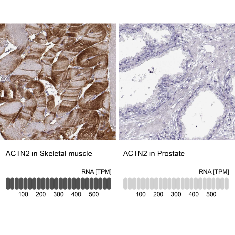 Atlas Antibodies Anti-ACTN2 Antibody
