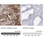 Atlas Antibodies Anti-ACTN2 Antibody